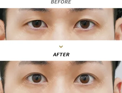 Before & After