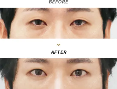 Before & After