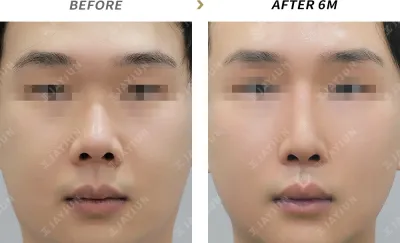 Before & After