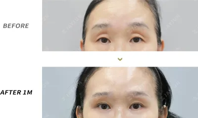 Before & After
