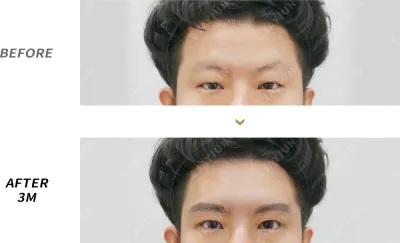 Before & After