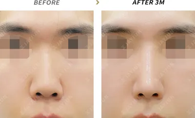 Before & After