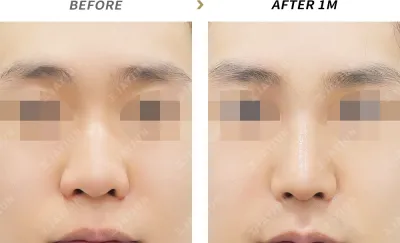 Before & After