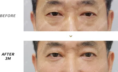 Before & After