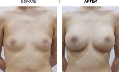 Before & After