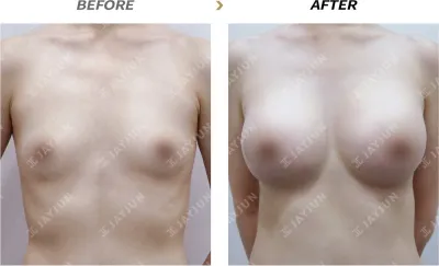 Before & After