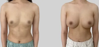 Before & After