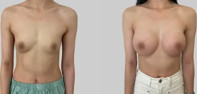 Before & After