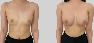 Before & After
