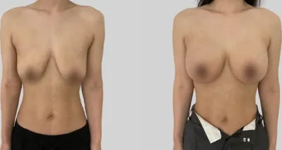 Before & After