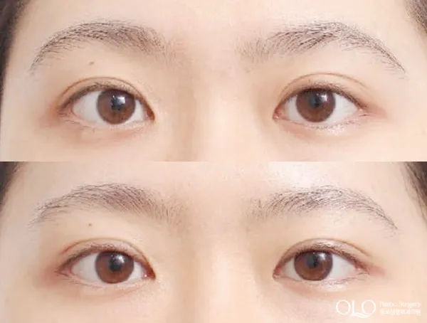 Before/After