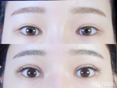 Before & After