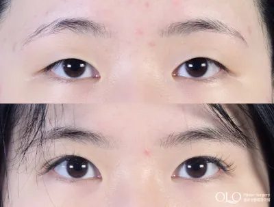Before & After