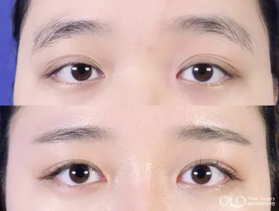 Before & After