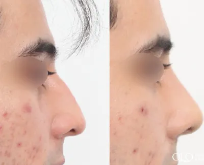 Before & After