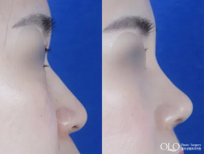Before & After