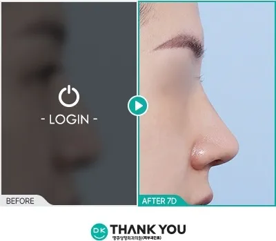 Before/After