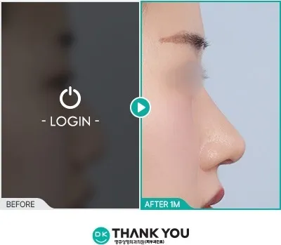 Before/After