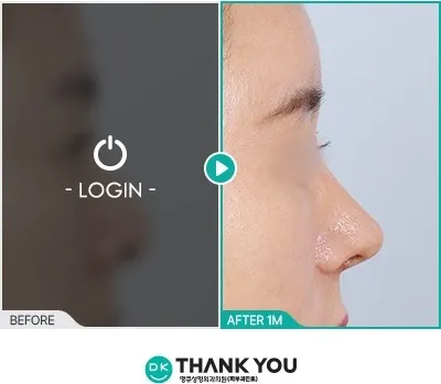 Before/After