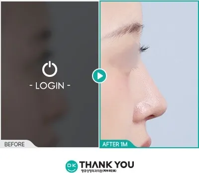 Before/After