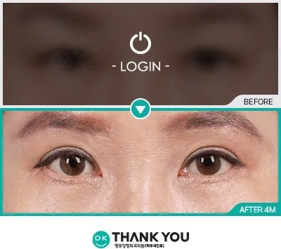 Before/After