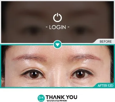 Before/After