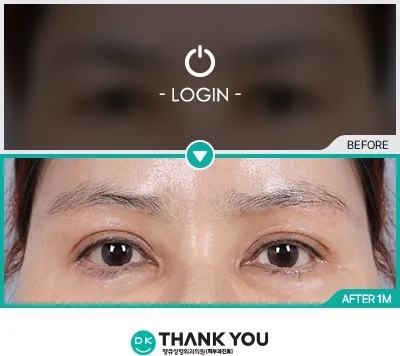 Before & After