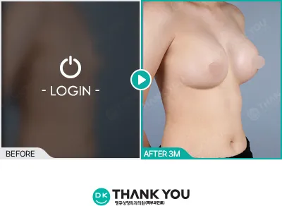 Before/After
