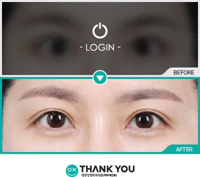 Before/After