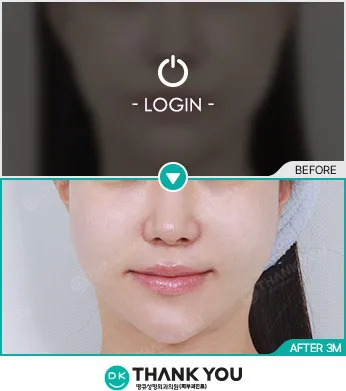 Before/After