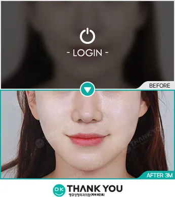 Before/After