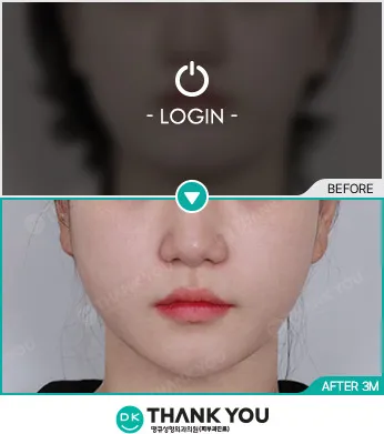 Before/After
