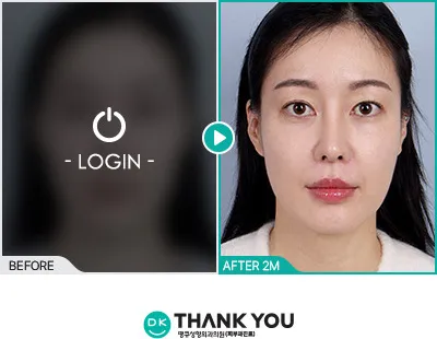 Before/After