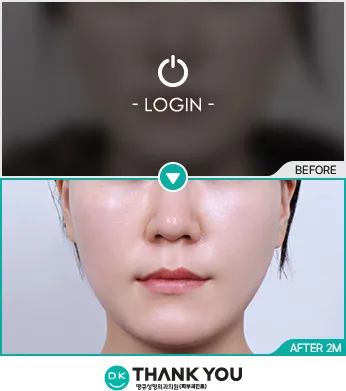 Before/After
