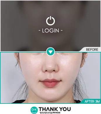 Before/After