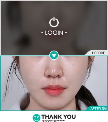 Before/After