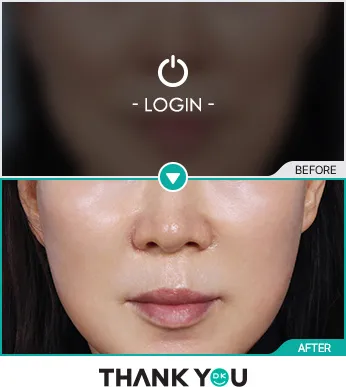 Before/After