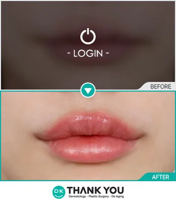 Before/After