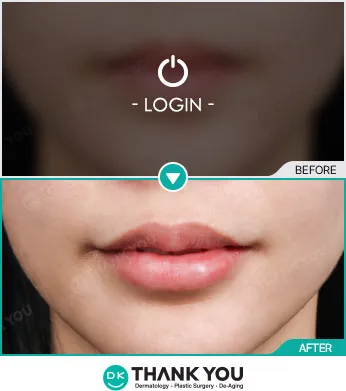 Before/After