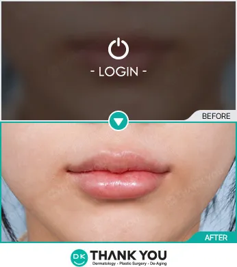 Before/After