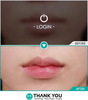 Before/After