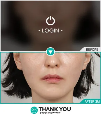 Before/After