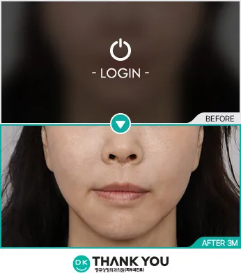 Before/After