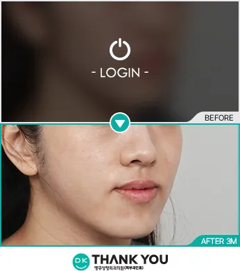 Before/After