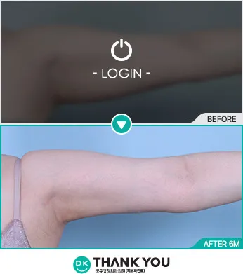 Before/After