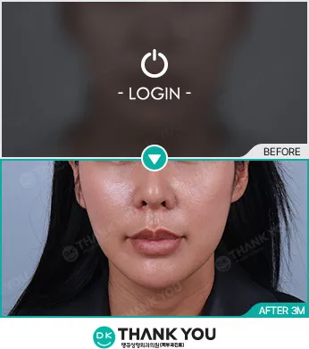 Before/After