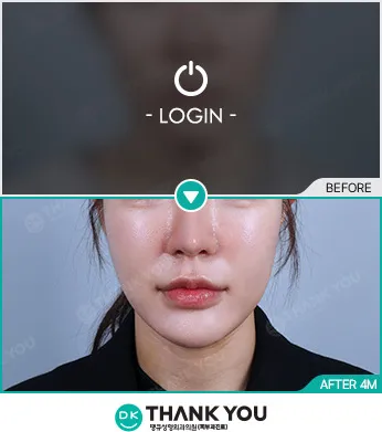 Before & After