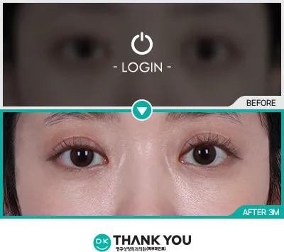 Before/After