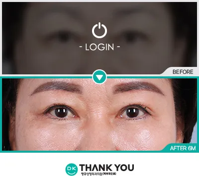 Before/After