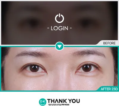 Before/After